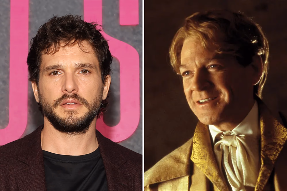 Kit Harington Is Gilderoy Lockhart in HBO's Harry Potter Series